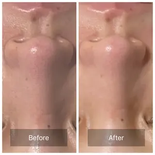 フェイシャルサロン ultimateのエステ・リラクイメージ