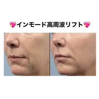 秒速小顔  恵比寿店所属・秒速小顔 恵比寿店 店長 さきのエステ・リラクイメージ