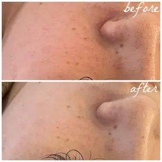 メンズ メナード岐阜市茜部 杉浦のエステ・リラクイメージ