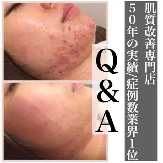 ミディアム カラー パーマ ヘアアレンジ メンズ キッズ ネイル マツエク・マツパ ニキビ・肌質改善専門 ♡人生が変わるサロンのエステ・リラクイメージ