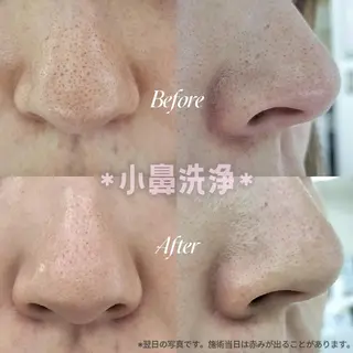 小川 アリサのマツエク・マツパデザイン