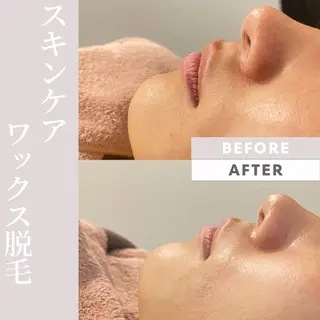 Purua beuty所属・月1肌管理 RINAのエステ・リラクイメージ