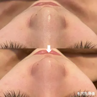 AnLimit 當山杏奈のエステ・リラクイメージ