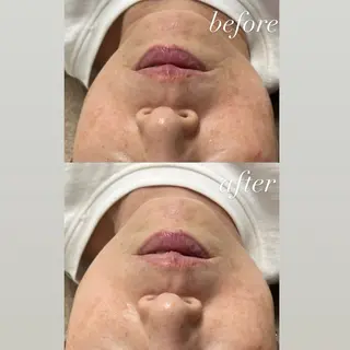 smileskin 京都／meguのその他イメージ