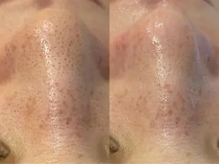 【都度払い脱毛 美肌脱毛】馬車道店のエステ・リラクイメージ