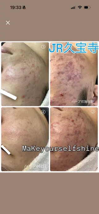 まいまい／八尾／JR 久宝寺／サロンのエステ・リラクイメージ