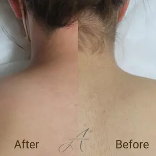 A*《エースター》 シュガーリング🍋のエステ・リラクイメージ