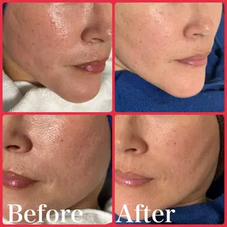 skin make salon -Olu's-所属・毛穴・肌質改善サロン ✨Tomaのその他イメージ