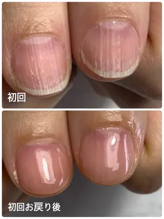 ネイル 大橋 愛のエステ・リラクイメージ