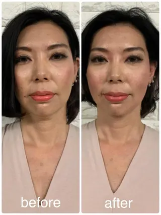 美容鍼 IKEZAKIのエステ・リラクイメージ