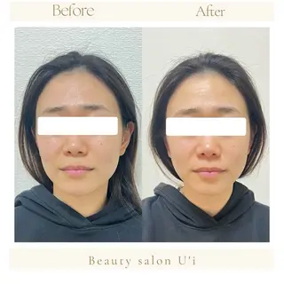 頭蓋骨小顔矯正 藤本のエステ・リラクイメージ