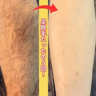 癒しの手リラクゼーション所属・癒しの手 リラクゼーションのエステ・リラクイメージ