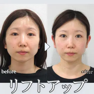 銀座美.design 立川店のエステ・リラクイメージ