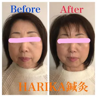 HARIKA鍼灸所属・HARIKA 鍼灸のその他イメージ
