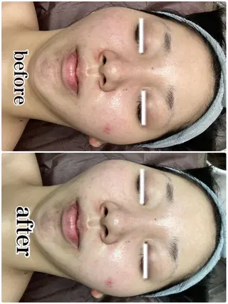 ◯△□所属・最新美肌脱毛 韓国水光肌🫧のその他イメージ