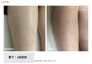 BERRY所属・サロン BERRYのエステ・リラクイメージ