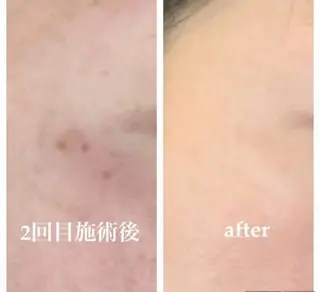 日髙 星奈のエステ・リラクイメージ