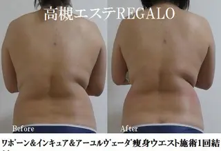 REGALO所属・矢野 さやかのエステ・リラクイメージ