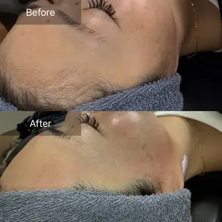 enine所属・enine フェイスWAXのエステ・リラクイメージ