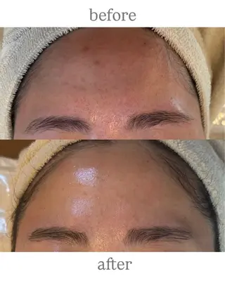 anthes /MIHOのエステ・リラクイメージ