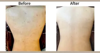 美肌脱毛サロン muroのエステ・リラクイメージ