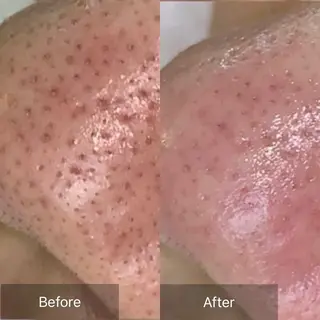 毛穴が見えなくなるサロン  Horo所属・岡 えり子のエステ・リラクイメージ