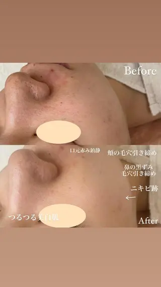 ネイル Private salon Dux所属・肌管理&nail Salon  Duxのエステ・リラクイメージ