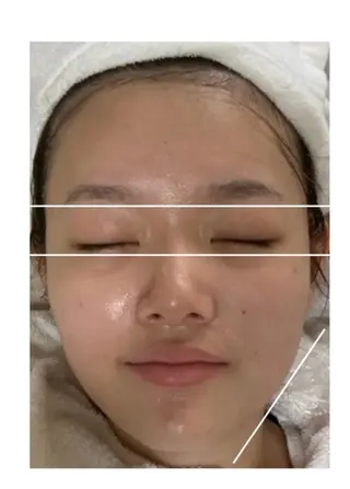 ヴィーナス ビューティーのエステ・リラクイメージ