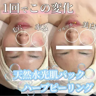 SALON所属・SALON韓国肌管理 東別院のエステ・リラクイメージ