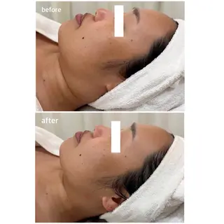 POLA salon Choco所属・肌ケアサロン御経塚北 オタニハルナのエステ・リラクイメージ