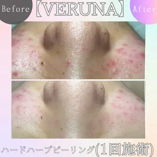 ニキビ改善専門店 d'Albaのエステ・リラクイメージ