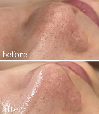 エステティック ロッカのエステ・リラクイメージ