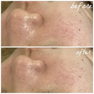 メンズ メナード岐阜市茜部 杉浦のエステ・リラクイメージ