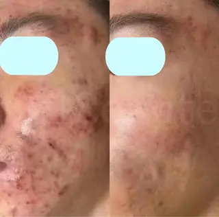 【新宿】 PulBeauteのエステ・リラクイメージ