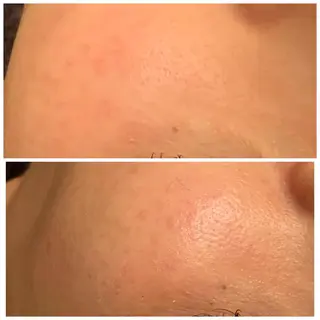 食べながら魅せボディ éclatJua川越のエステ・リラクイメージ