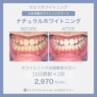 ホワイトニング専門店 PLATINUM Beauty 川崎店所属・PLATINUM Beauty 川崎店のその他イメージ