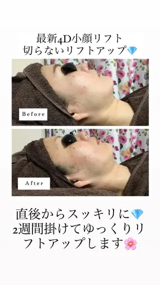 セミロング カラー パーマ ヘアアレンジ メンズ キッズ ネイル マツエク・マツパ Chloe-クロエ- 脱毛/フェイシャルのエステ・リラクイメージ