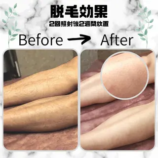 メンズ キッズ 男女同額完全個室脱毛 LEPIA内田のエステ・リラクイメージ