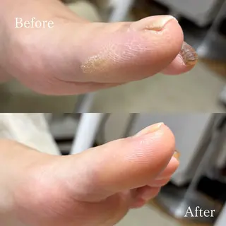 ネイル 深爪・巻き爪 専門サンセリテのネイルデザイン