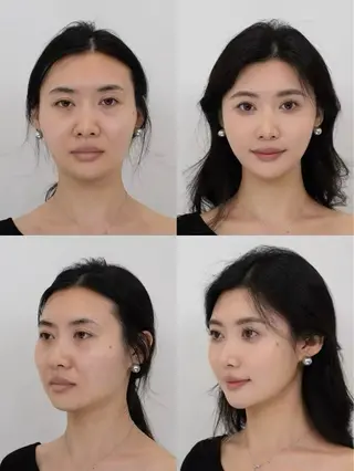 カラー aliaハイフ&水光ジェットサロン所属・aliaハーブ水光店 エステティシャン募集のエステ・リラクイメージ