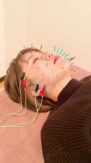 美容鍼灸サロン　TIARA所属・鍼灸サロン TIARA　美容鍼のエステ・リラクイメージ