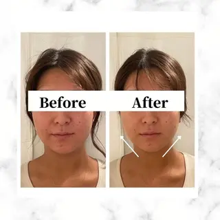 12Dハイフ💗 最強小顔のエステ・リラクイメージ