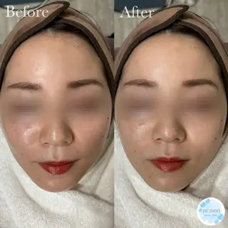 美容鍼脱毛salon リノン吹田駅前店のエステ・リラクイメージ