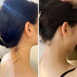 うなじ脱毛/美肌脱毛 LABELのエステ・リラクイメージ