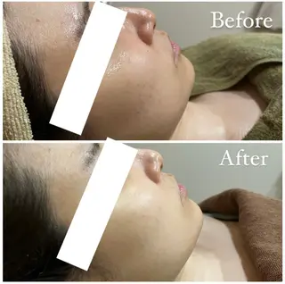 ハーブピーリング専門 muro.のエステ・リラクイメージ