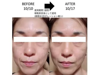 トラブル肌専門店 PLACE梅田堂山店のエステ・リラクイメージ