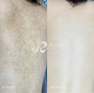 SALON BioBioのエステ・リラクイメージ