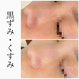 ハーブピーリング専門 BIOPLUS＋川崎のエステ・リラクイメージ