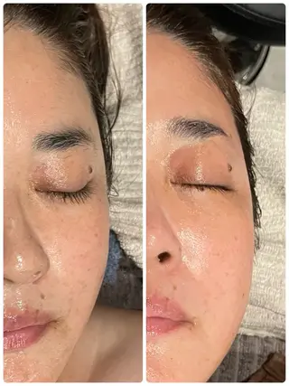 エステ／ネイル/脱毛 R.Msalonのネイルデザイン