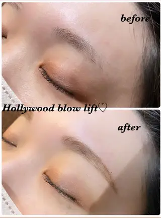 アイブロウ ハーブピーリング/韓国肌管理/フェイシャル/毛穴洗浄/眉毛/顔脱毛【糸脱毛専門】rev所属・ハーブピーリング🌹 毛穴洗浄❤️眉waxのエステ・リラクイメージ